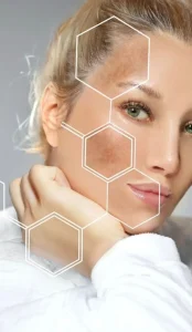 مدت زمان تاثیر قرص پیگمنتا