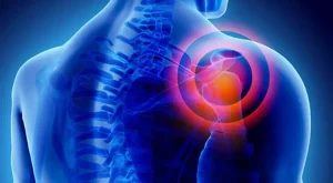 کتف بند برای افتادگی شانه و درد شانه