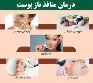 بهترین روش درمان منافذ باز پوست