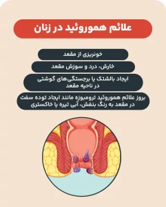 علائم بواسیر در زنان